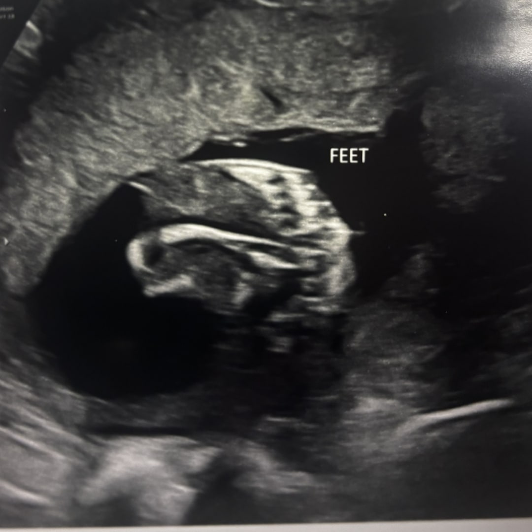 Photo shared by Amanda for their Babylist baby registry.