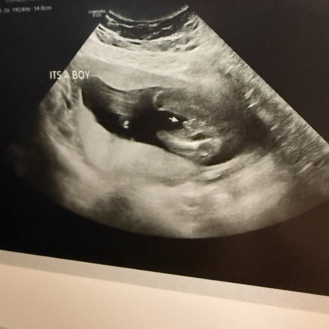 Photo shared by Hannah for their Babylist baby registry.