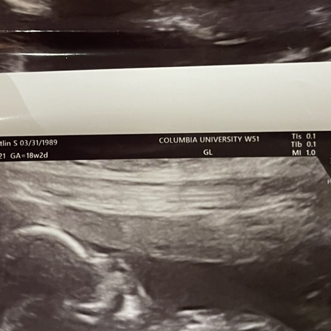 Photo shared by Kaitlin for their Babylist baby registry.