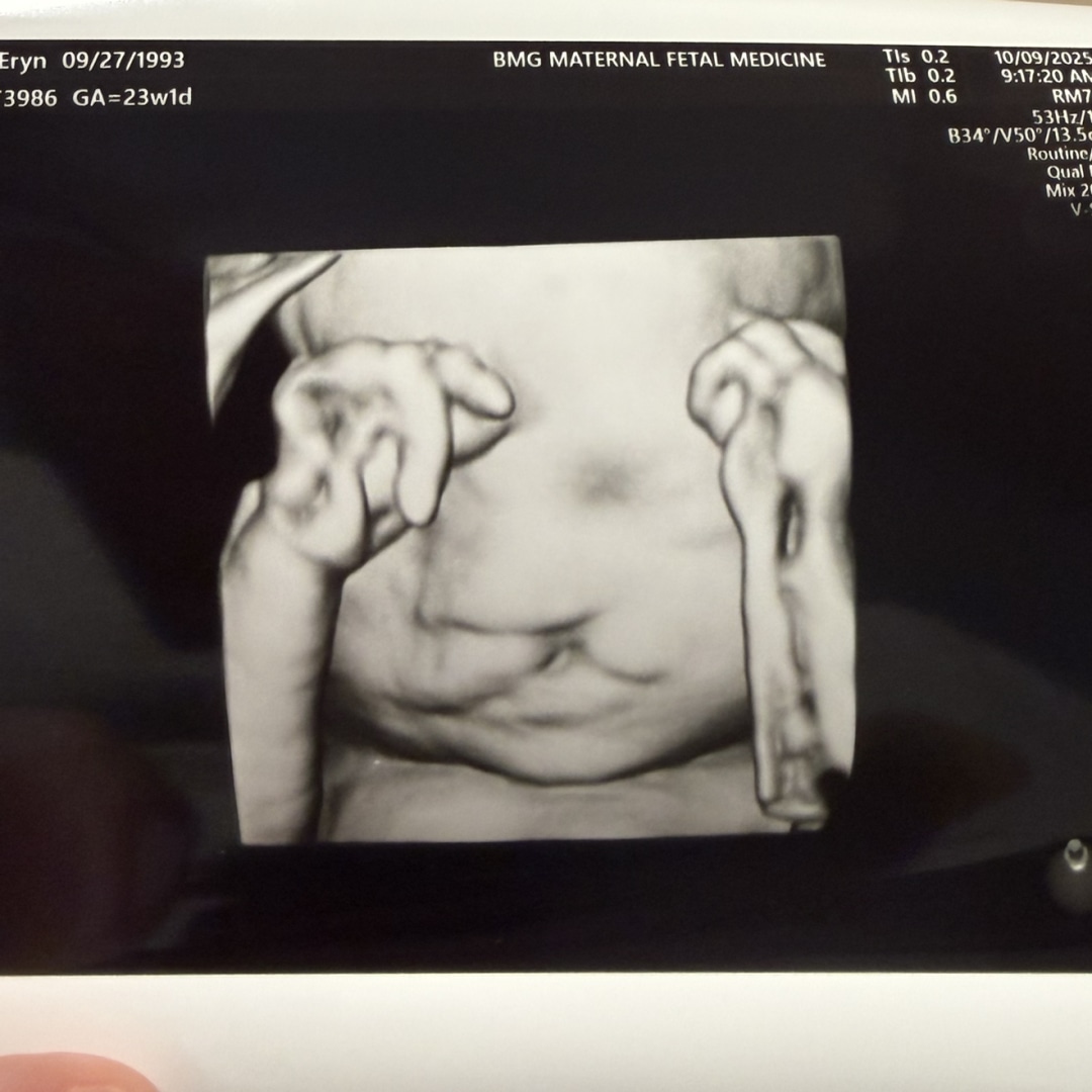 Photo shared by Eryn for their Babylist baby registry.