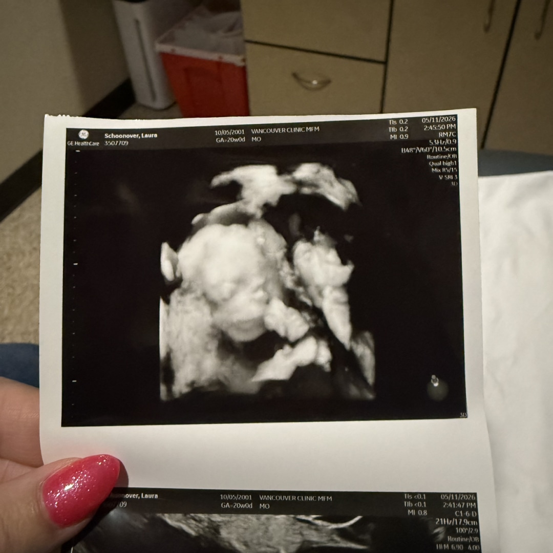 Photo shared by Laura for their Babylist baby registry.