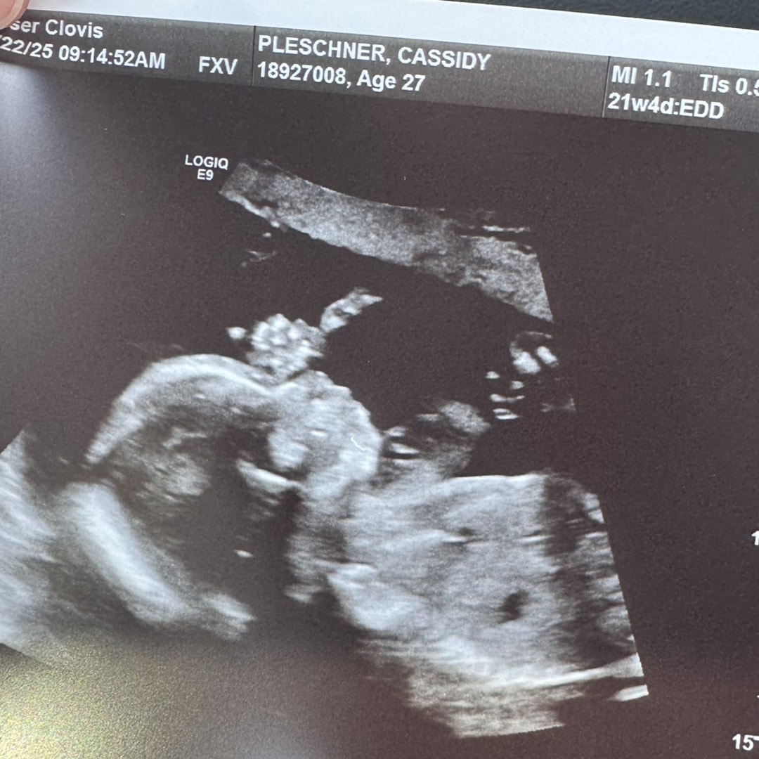 Photo shared by Cassidy for their Babylist baby registry.