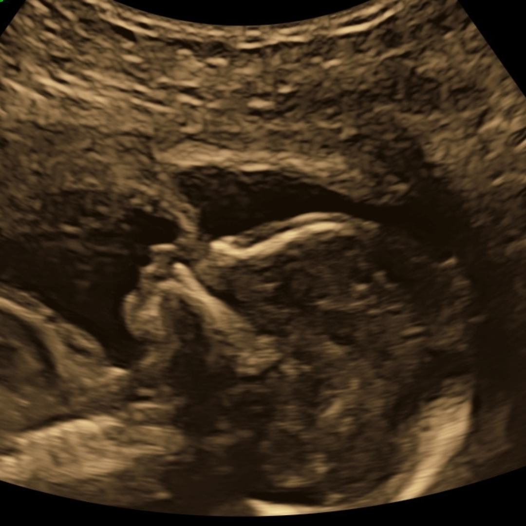 Photo shared by Gabby for their Babylist baby registry.