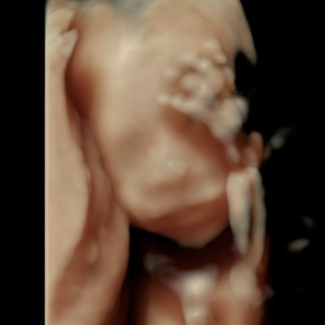 Photo shared by McKenna for their Babylist baby registry.