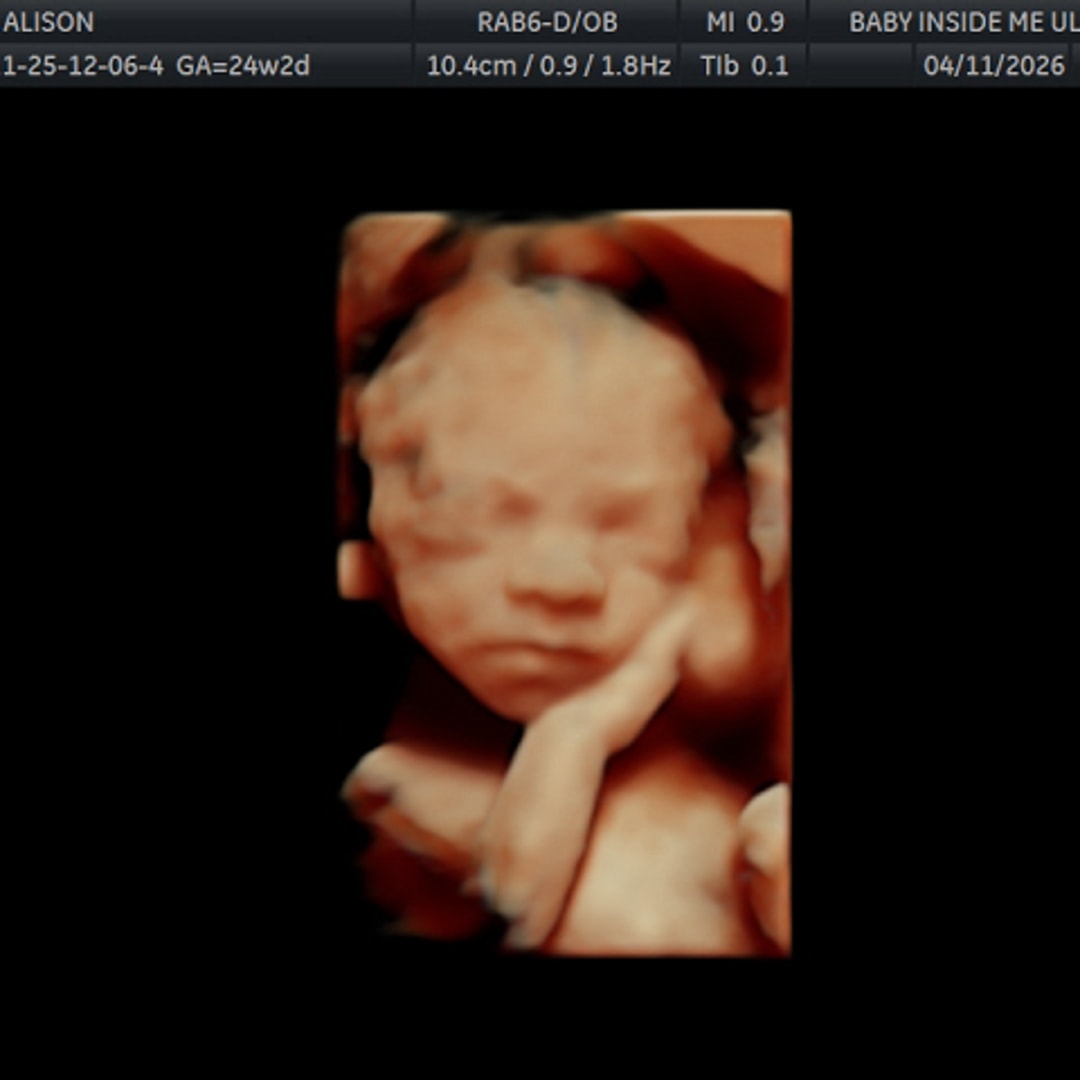Photo shared by Alison for their Babylist baby registry.