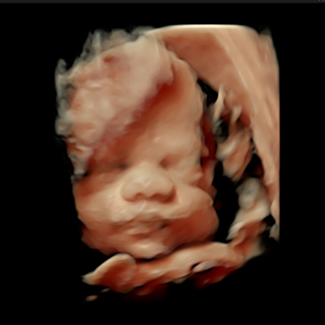 Photo shared by Brayden for their Babylist baby registry.