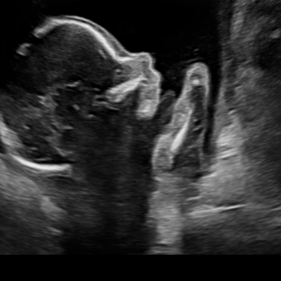 Photo shared by Shaylee for their Babylist baby registry.