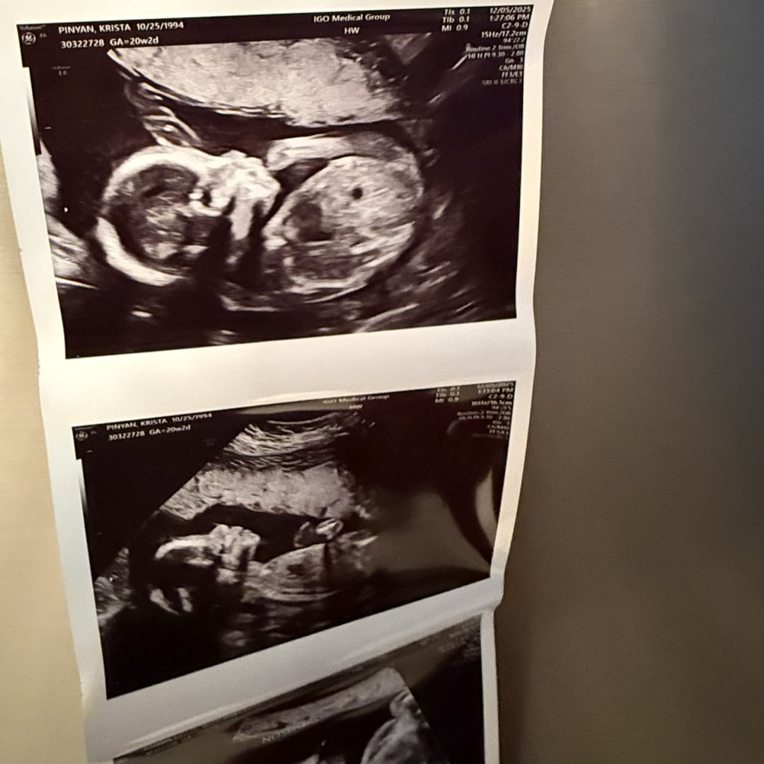 Photo shared by Krista for their Babylist baby registry.