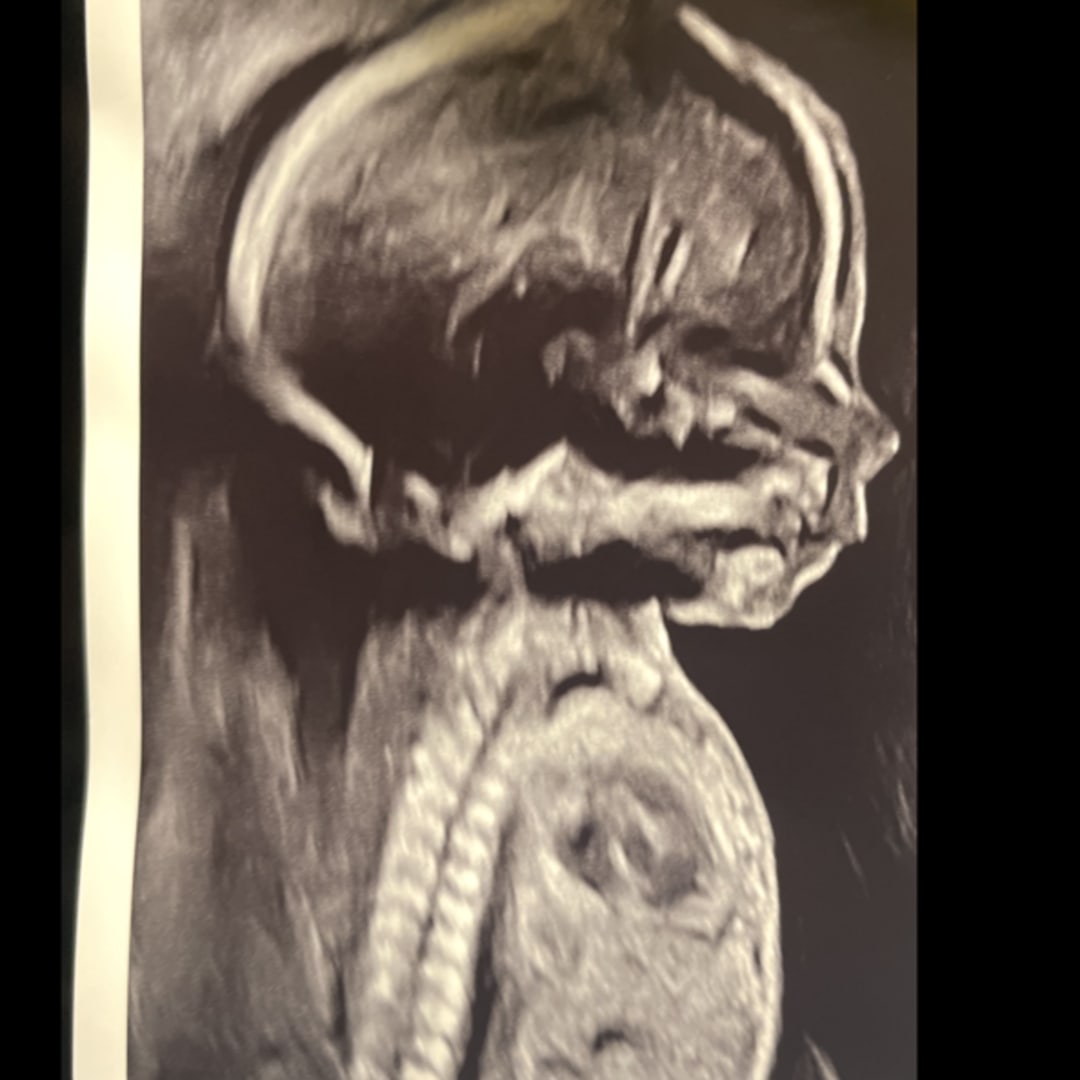 Photo shared by Jessica for their Babylist baby registry.