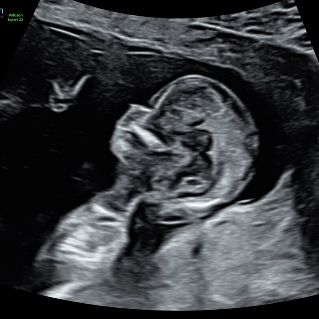 Photo shared by Brianna for their Babylist baby registry.