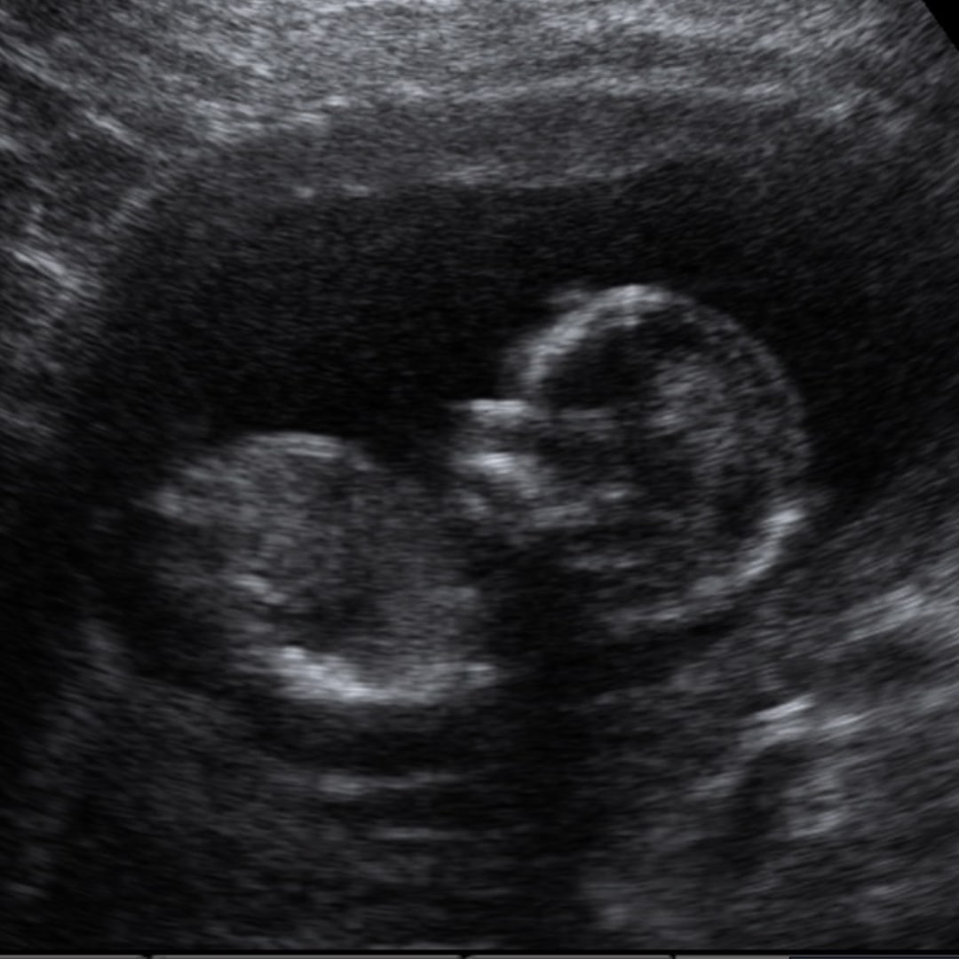 Photo shared by Blakelyn for their Babylist baby registry.