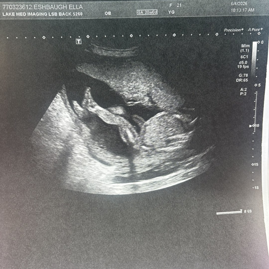 Photo shared by Ella for their Babylist baby registry.