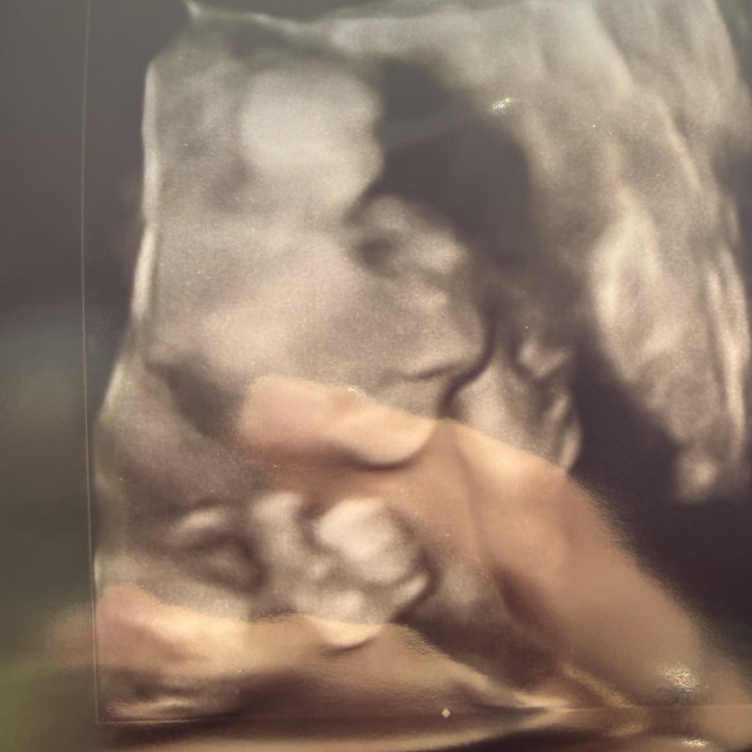 Photo shared by Madison for their Babylist baby registry.