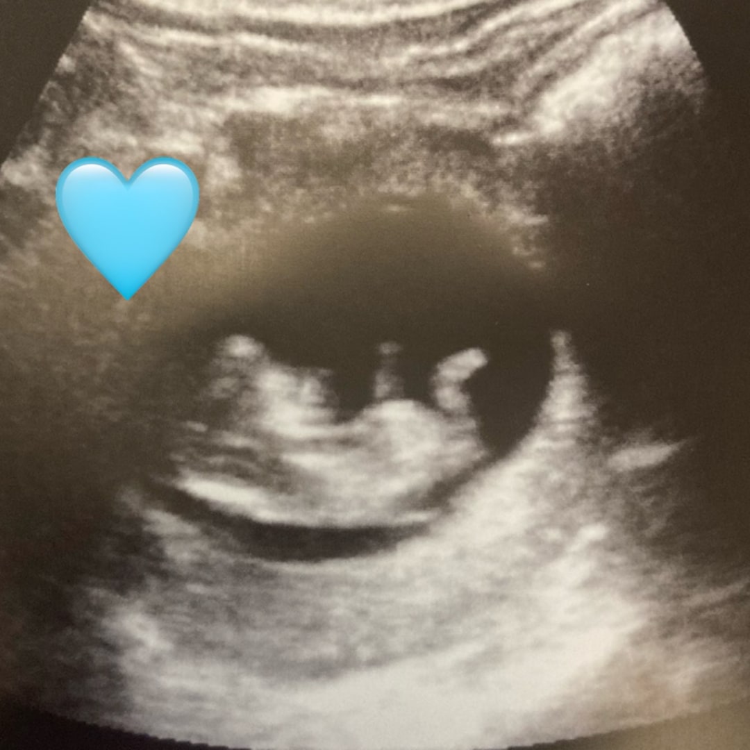 Photo shared by Maureen for their Babylist baby registry.