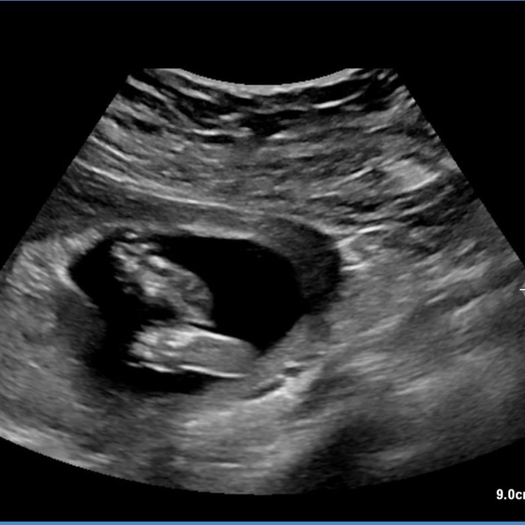 Photo shared by Calley for their Babylist baby registry.