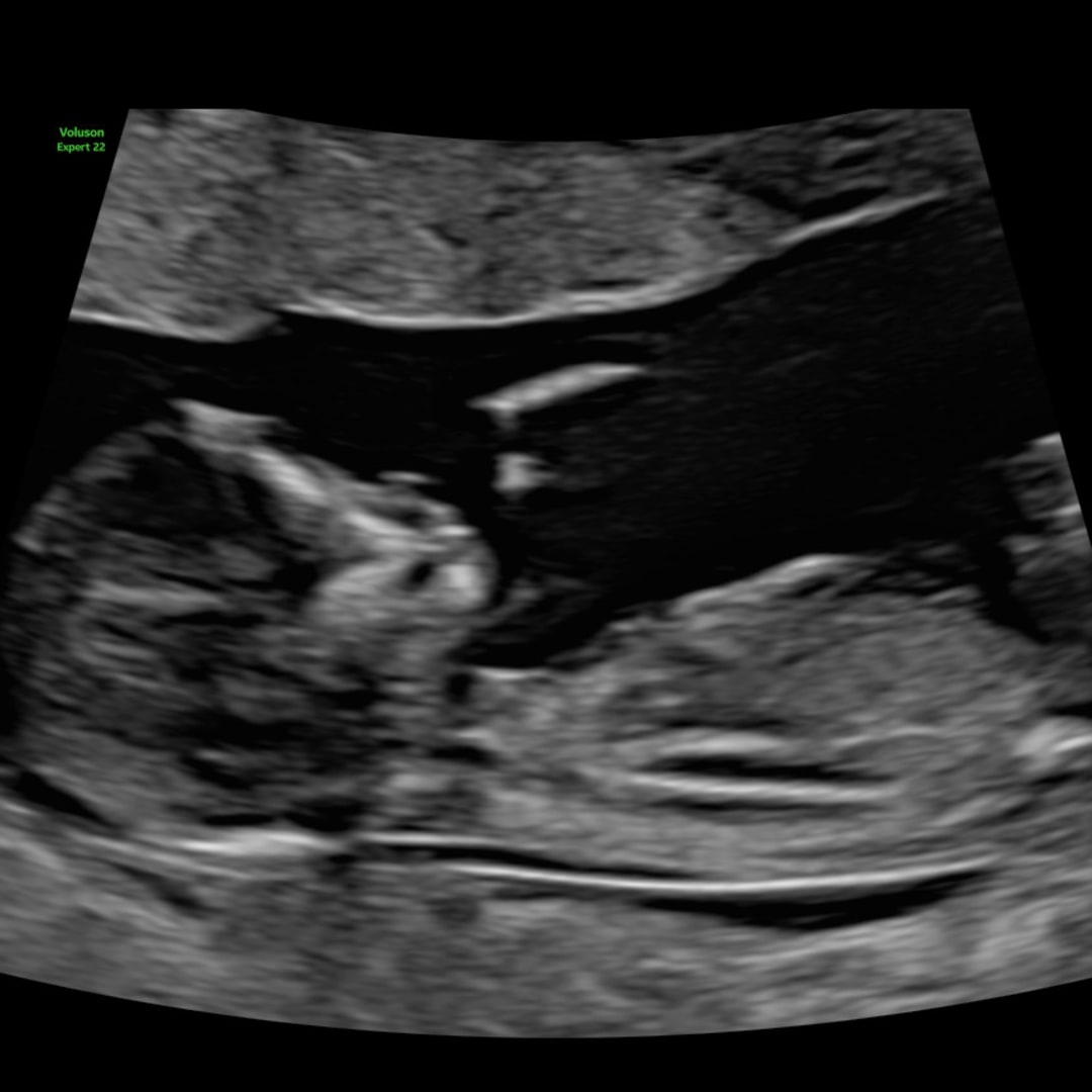 Photo shared by Ann for their Babylist baby registry.