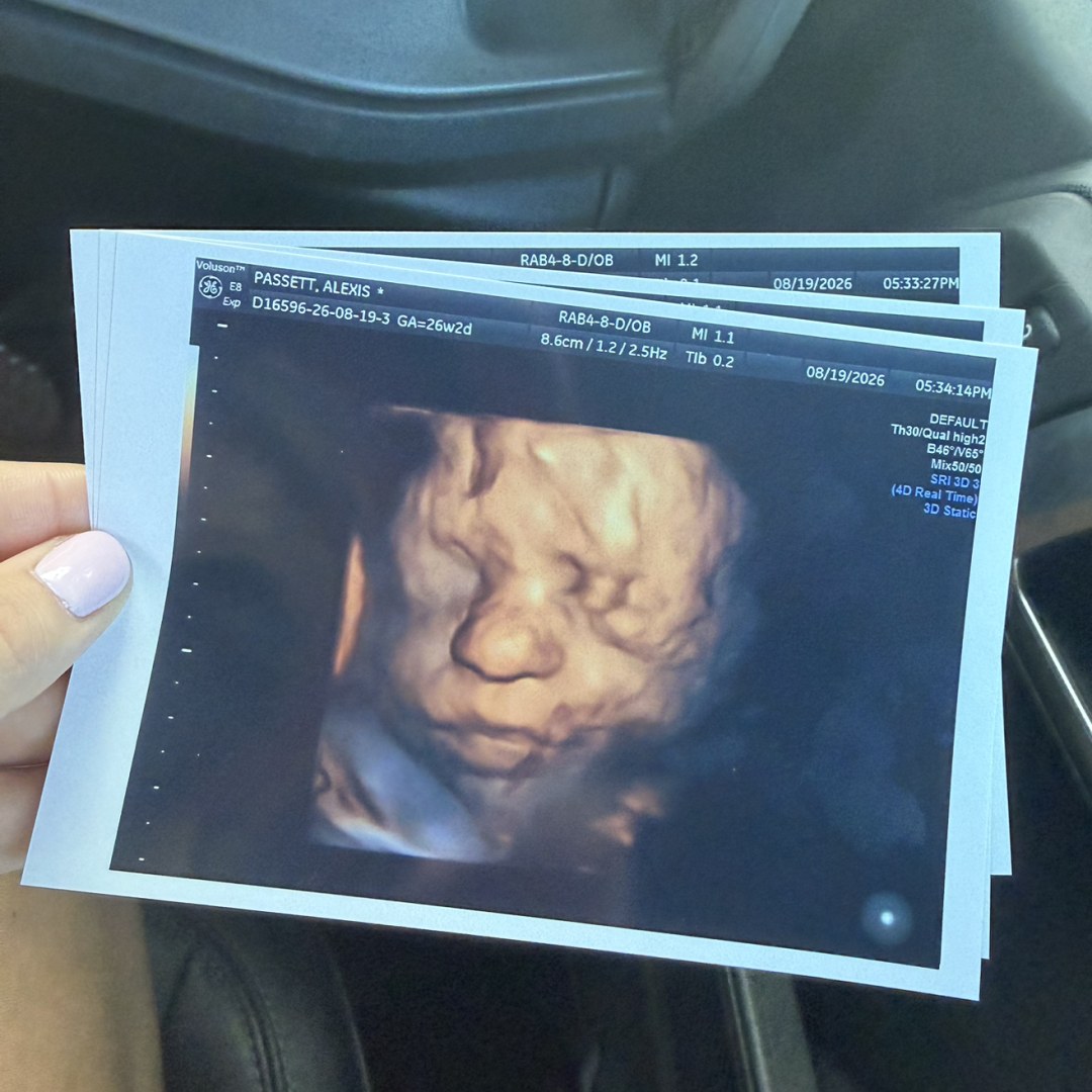 Photo shared by Alexis for their Babylist baby registry.