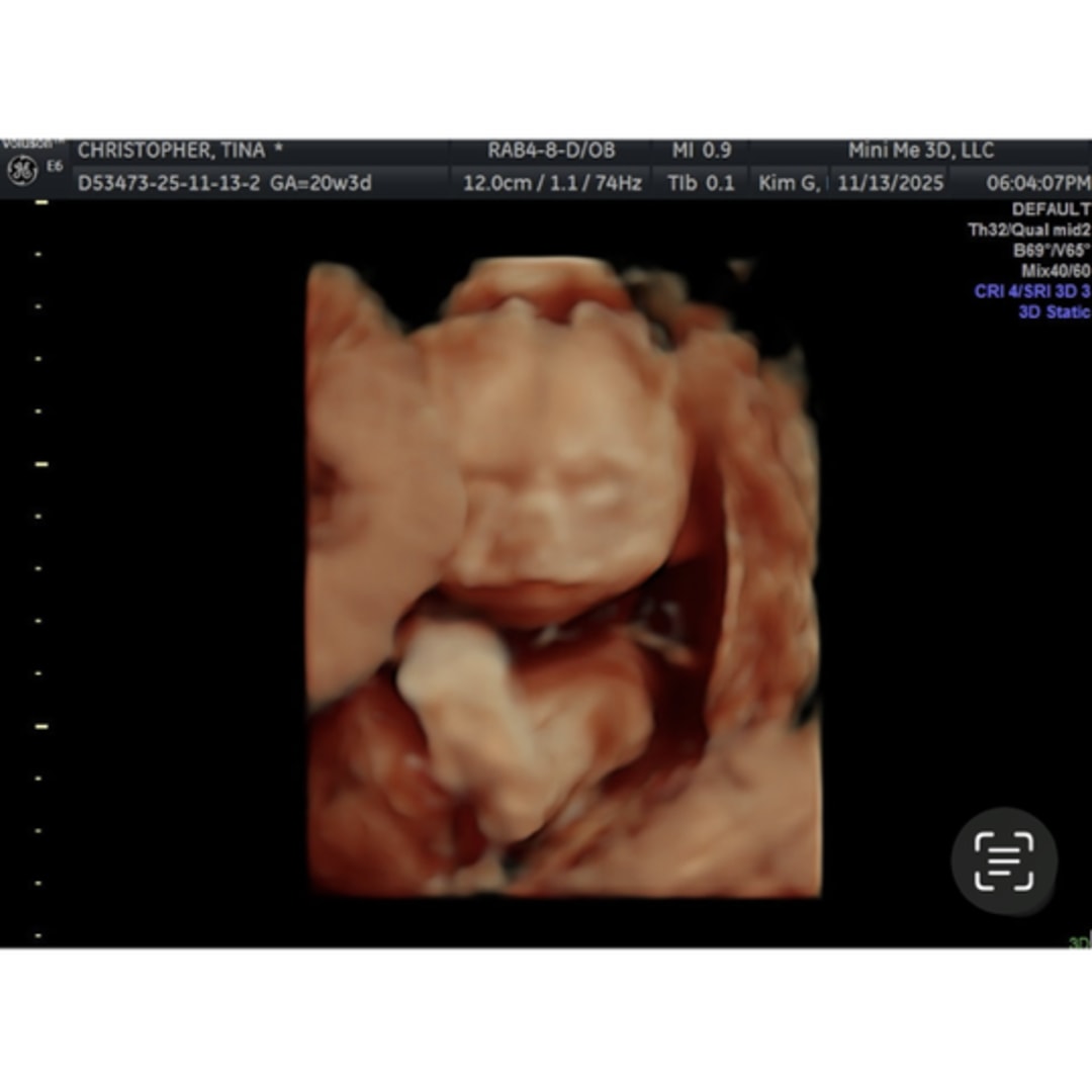 Photo shared by Tina for their Babylist baby registry.