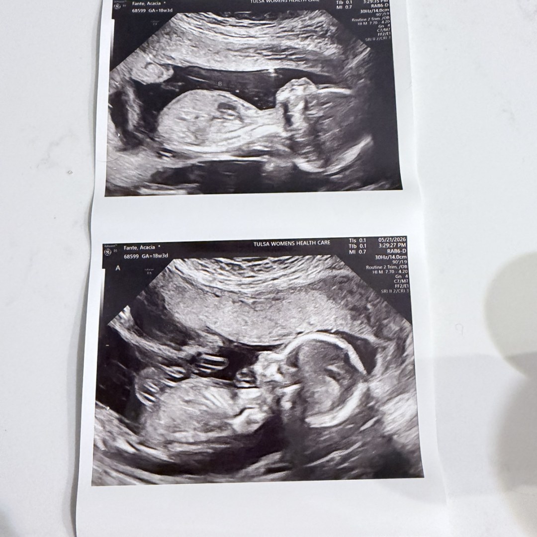 Photo shared by Acacia for their Babylist baby registry.