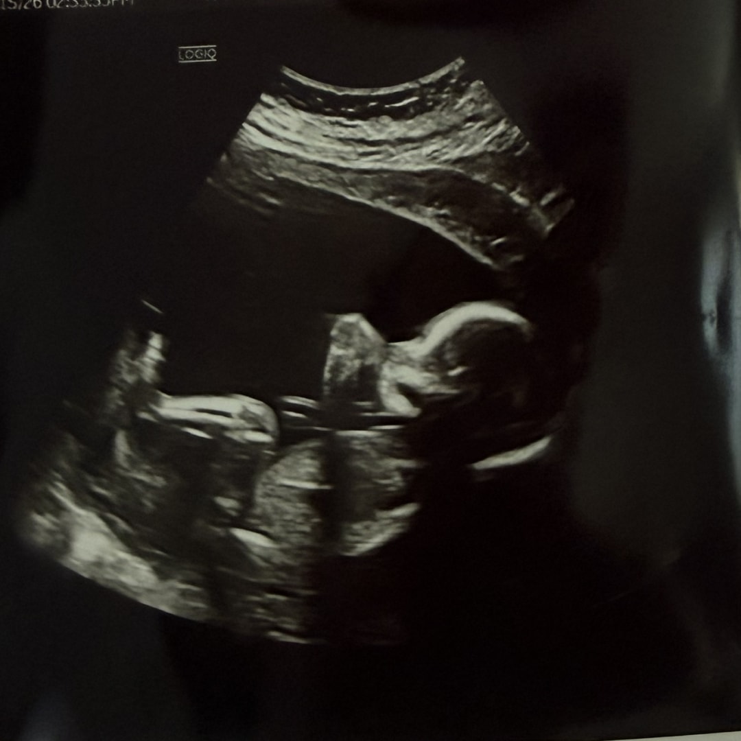 Photo shared by Gracie for their Babylist baby registry.