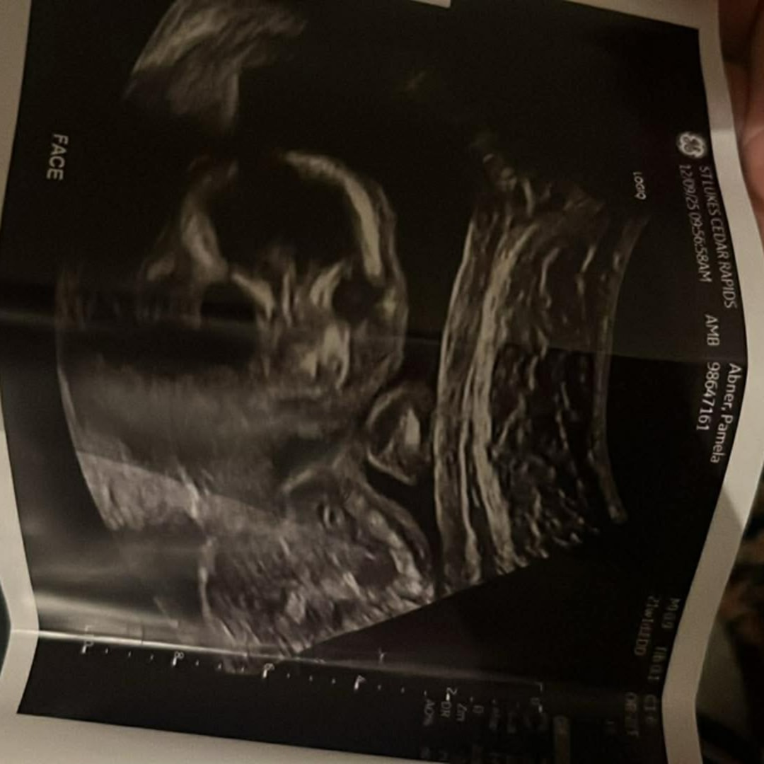 Photo shared by Pamela for their Babylist baby registry.