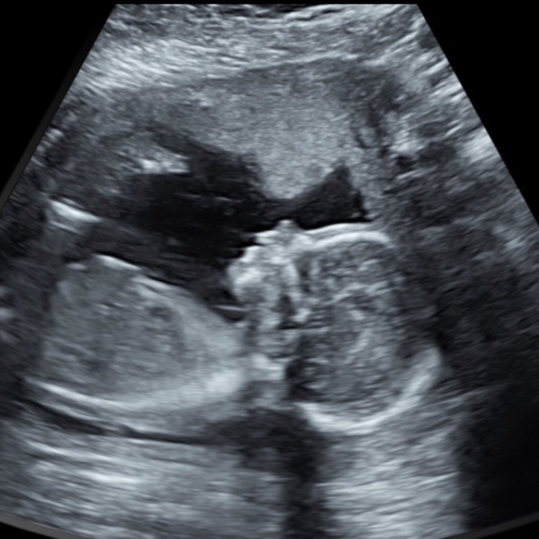 Photo shared by Cristina for their Babylist baby registry.