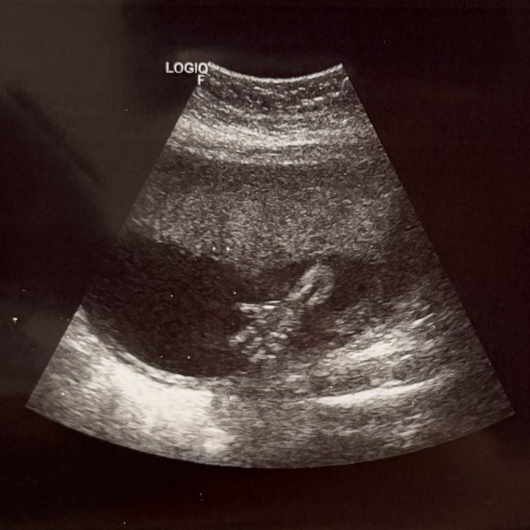 Photo shared by Allie for their Babylist baby registry.