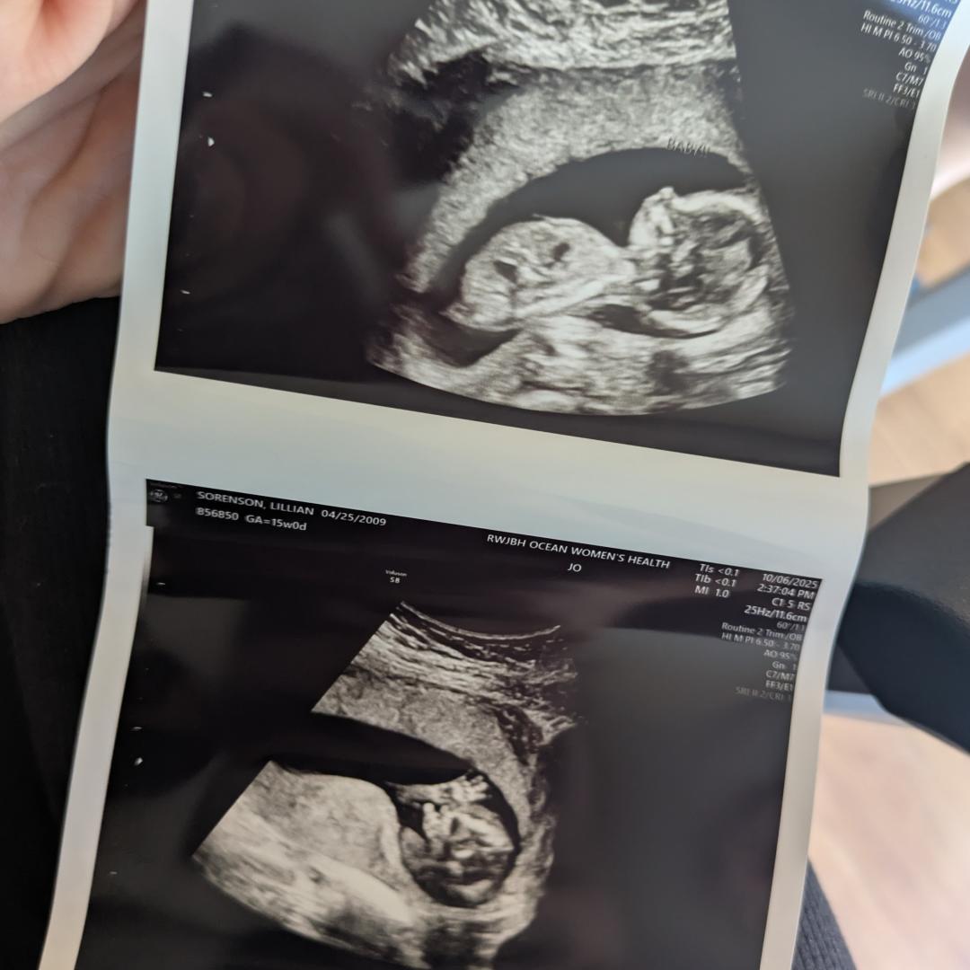 Photo shared by Lilly for their Babylist baby registry.