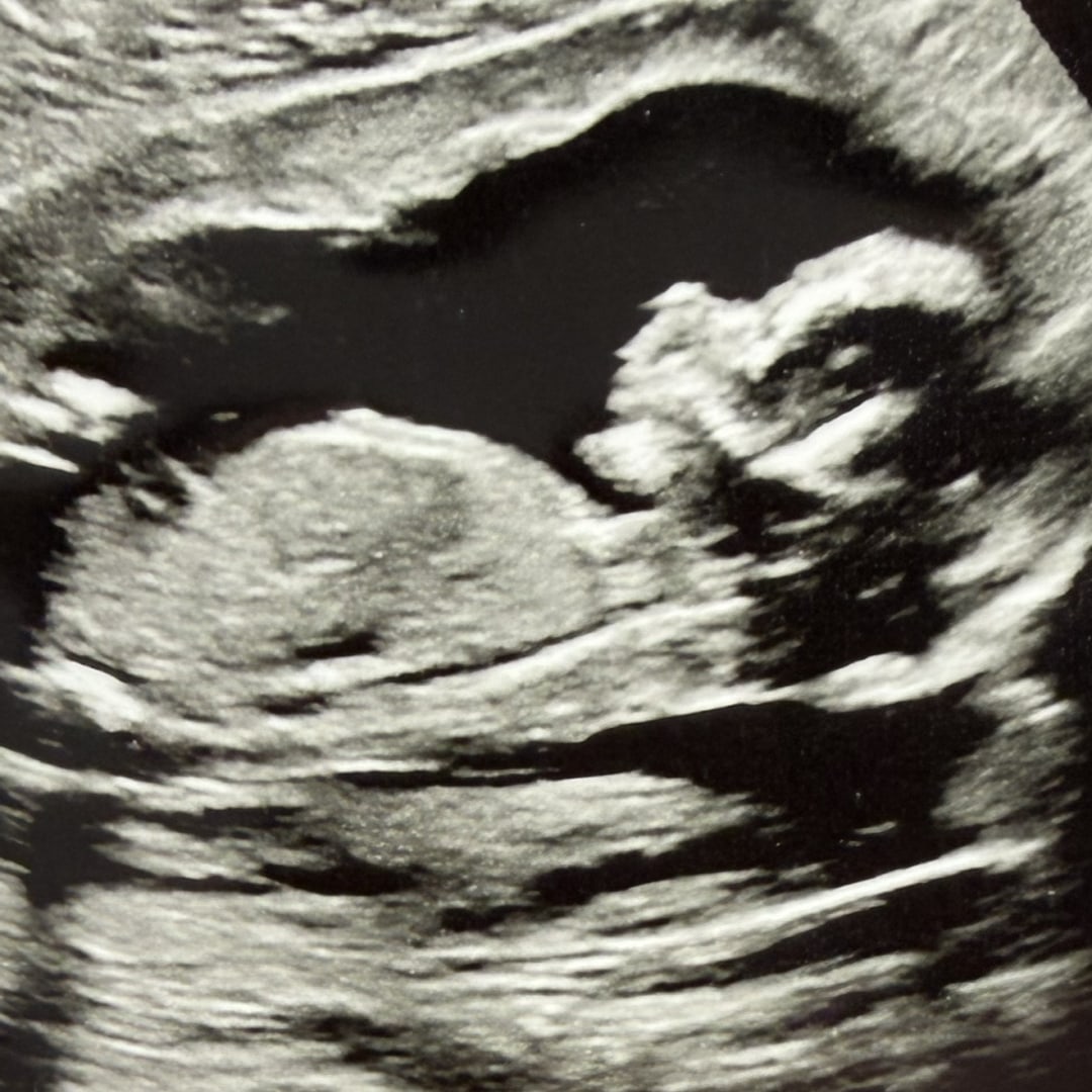 Photo shared by Karly for their Babylist baby registry.