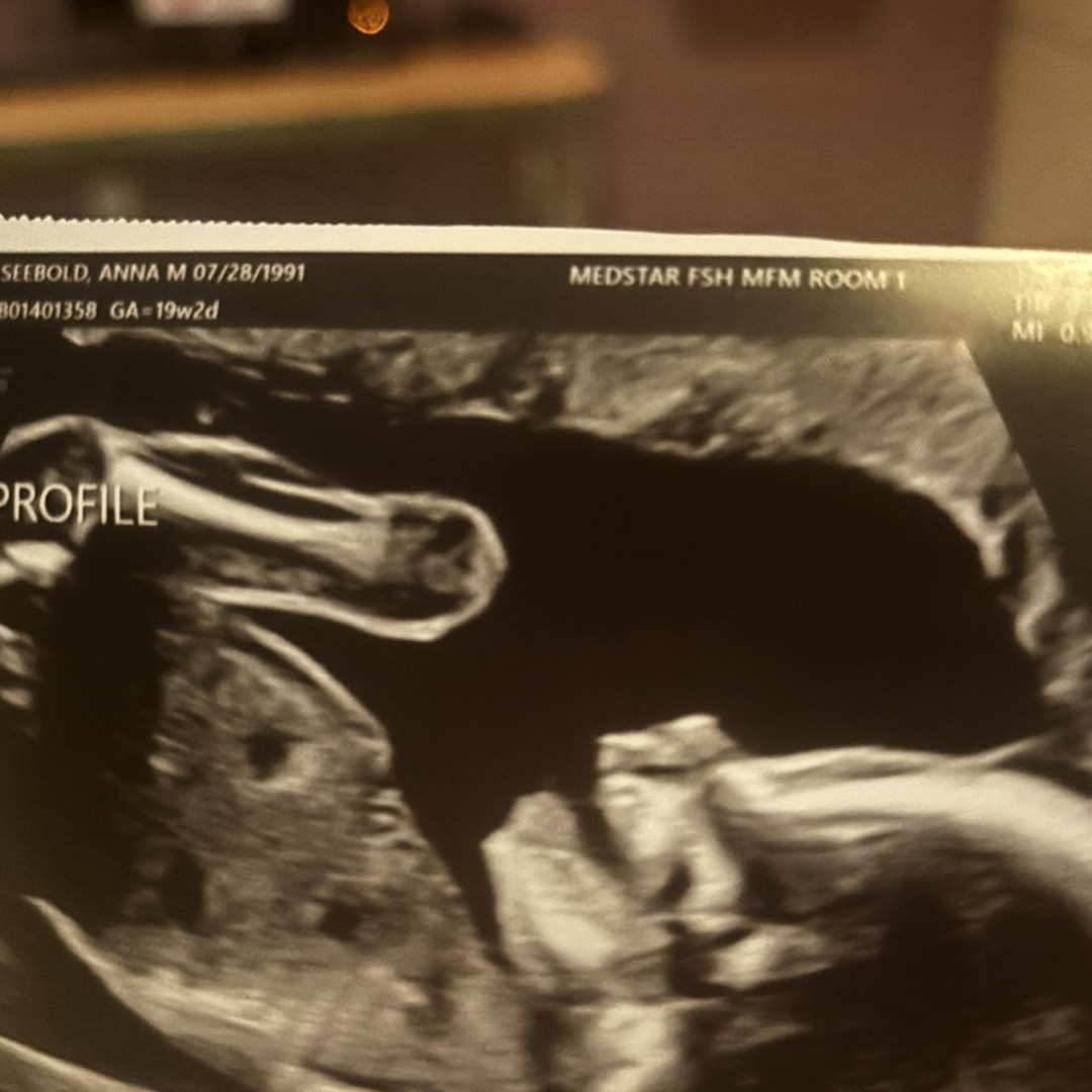 Photo shared by Anna for their Babylist baby registry.