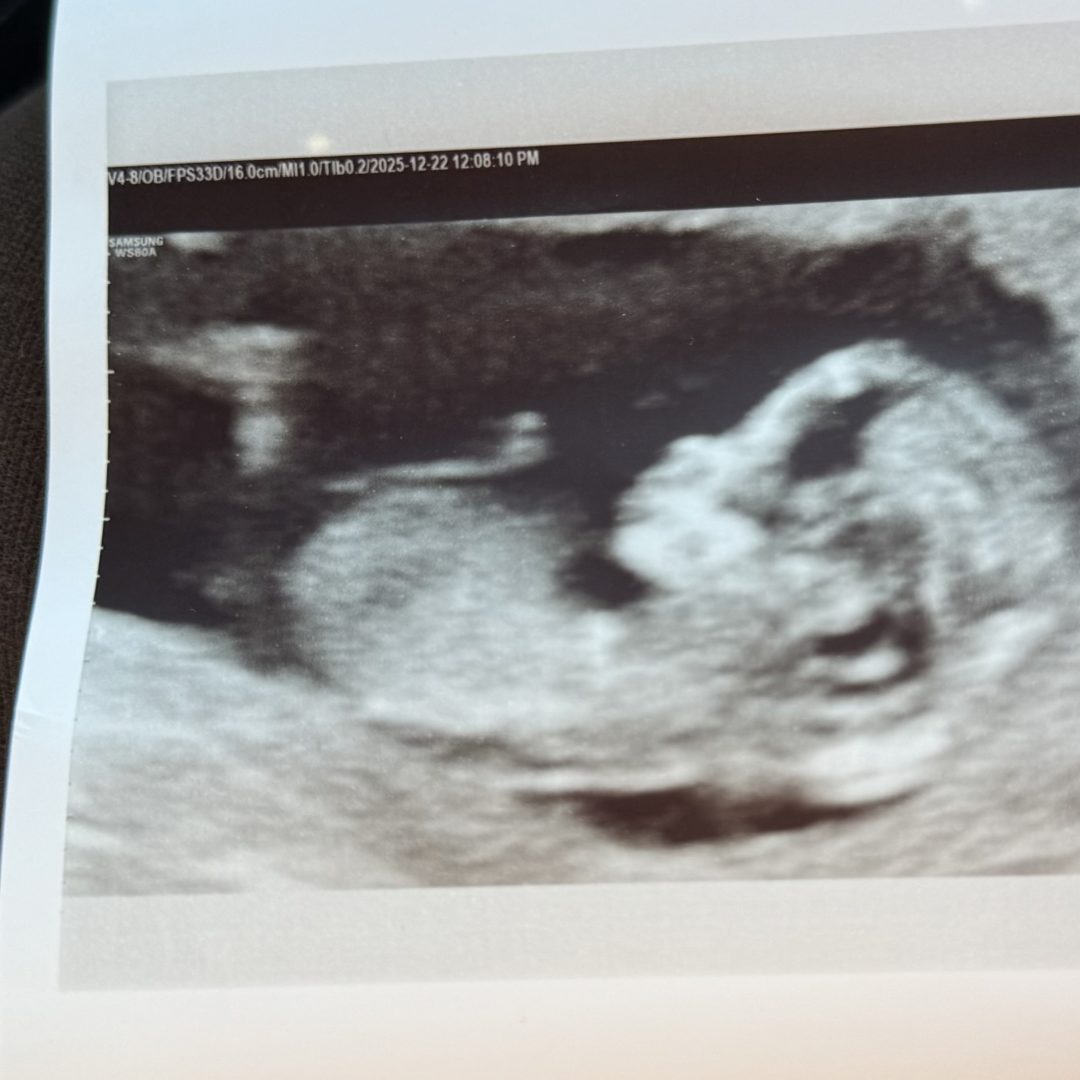 Photo shared by Bridget for their Babylist baby registry.