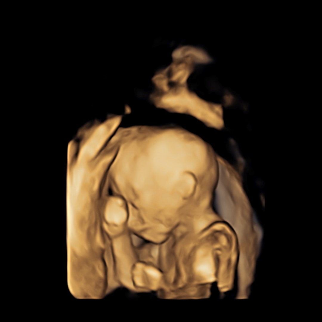 Photo shared by Danielle for their Babylist baby registry.