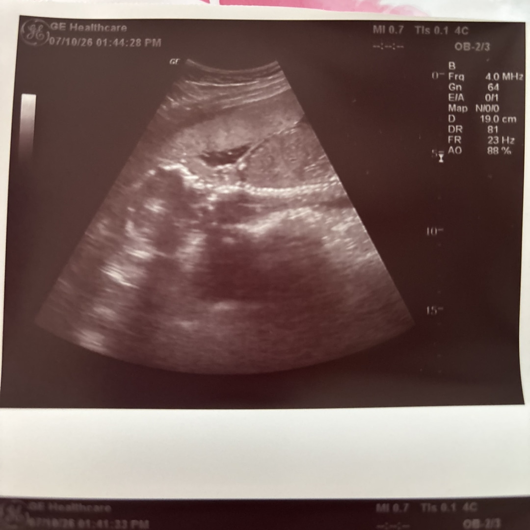 Photo shared by Ella for their Babylist baby registry.