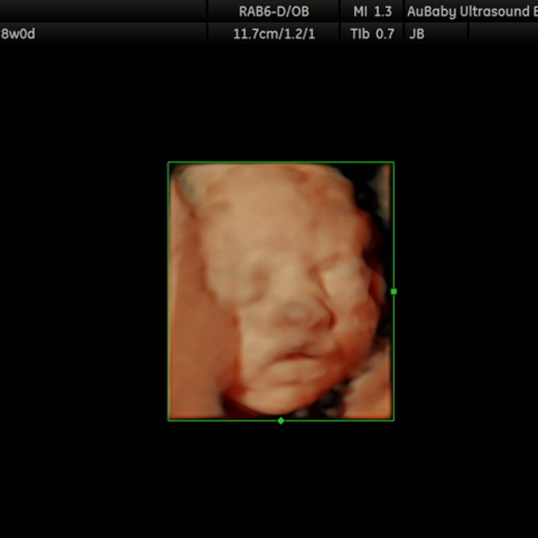Photo shared by Karley for their Babylist baby registry.