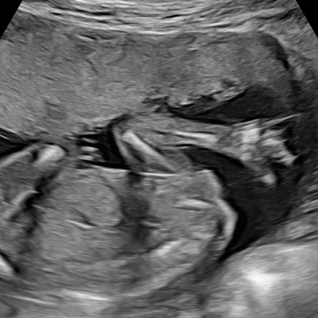 Photo shared by Sarah for their Babylist baby registry.