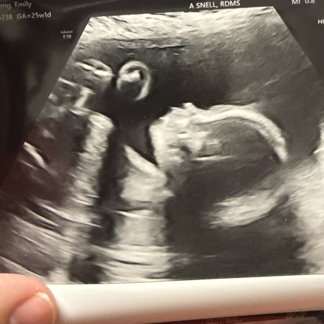 Photo shared by Emily for their Babylist baby registry.