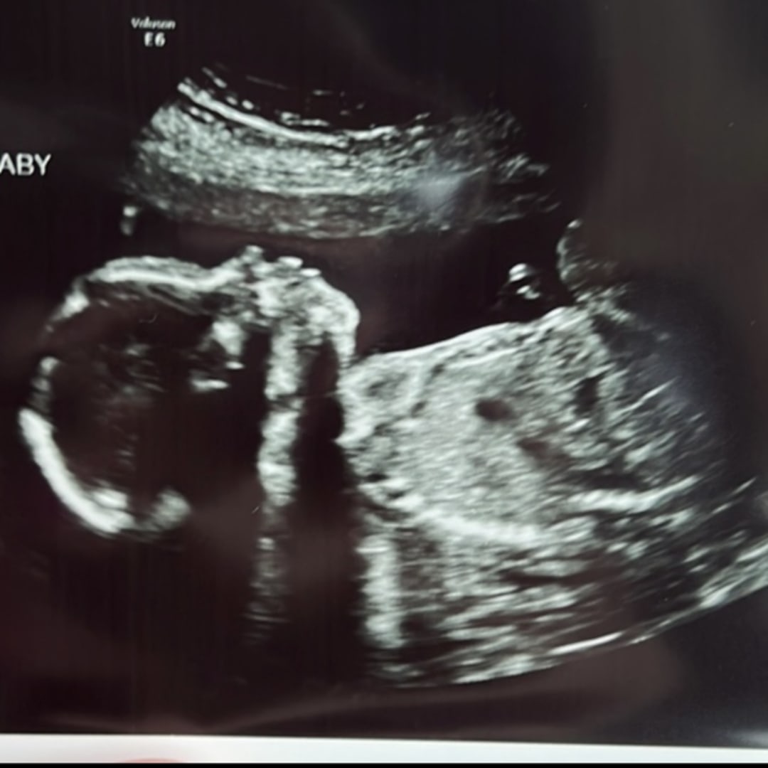 Photo shared by Abigail for their Babylist baby registry.