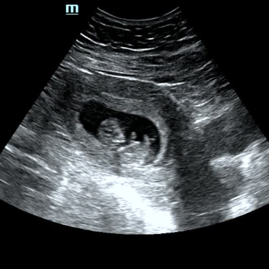 Photo shared by Hailey for their Babylist baby registry.