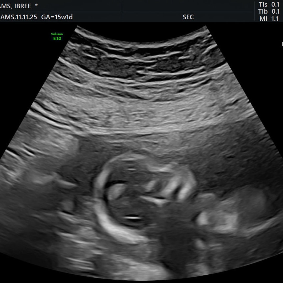 Photo shared by Ibree for their Babylist baby registry.