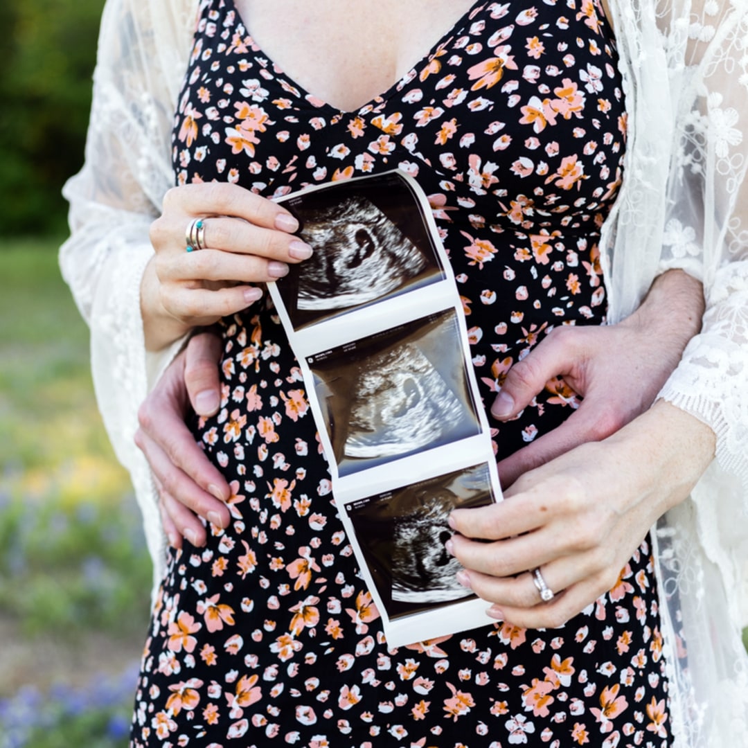 Photo shared by Cora for their Babylist baby registry.