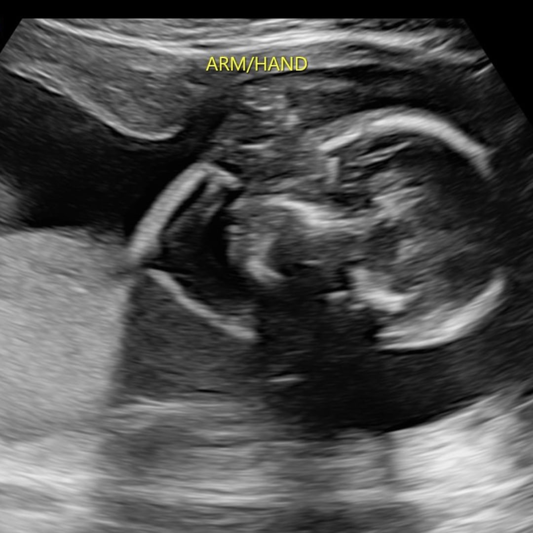 Photo shared by Branasia for their Babylist baby registry.