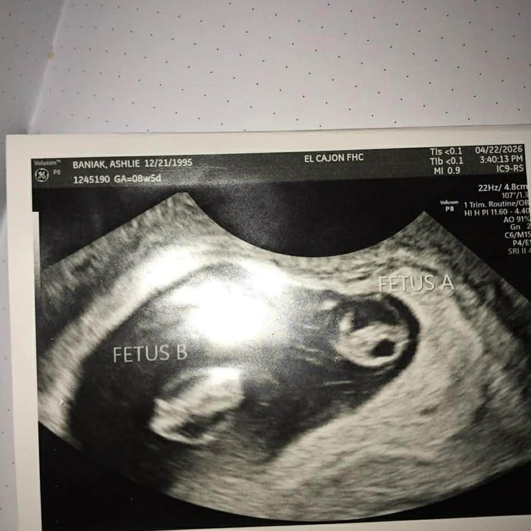 Photo shared by Ashlie for their Babylist baby registry.