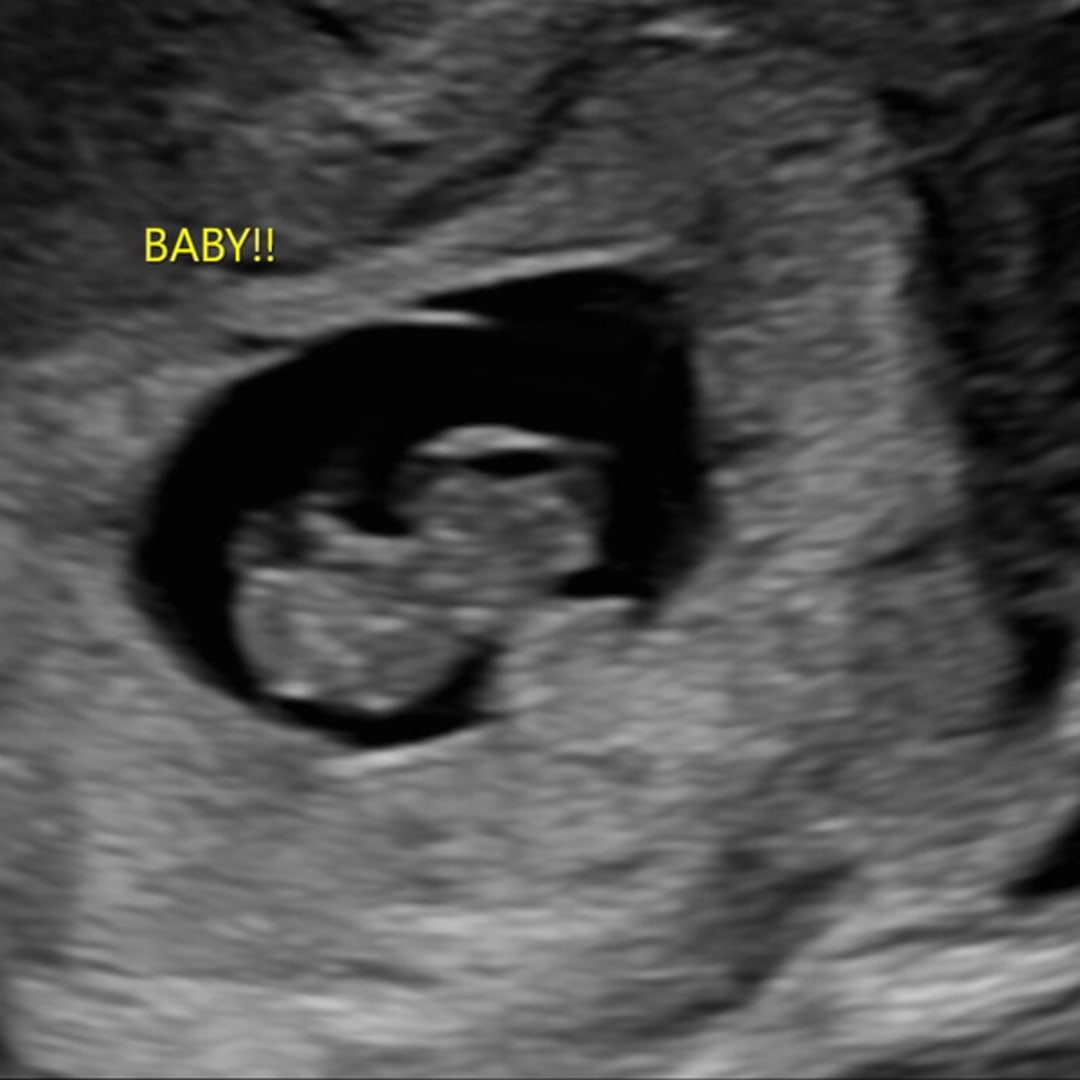 Photo shared by Jordan for their Babylist baby registry.