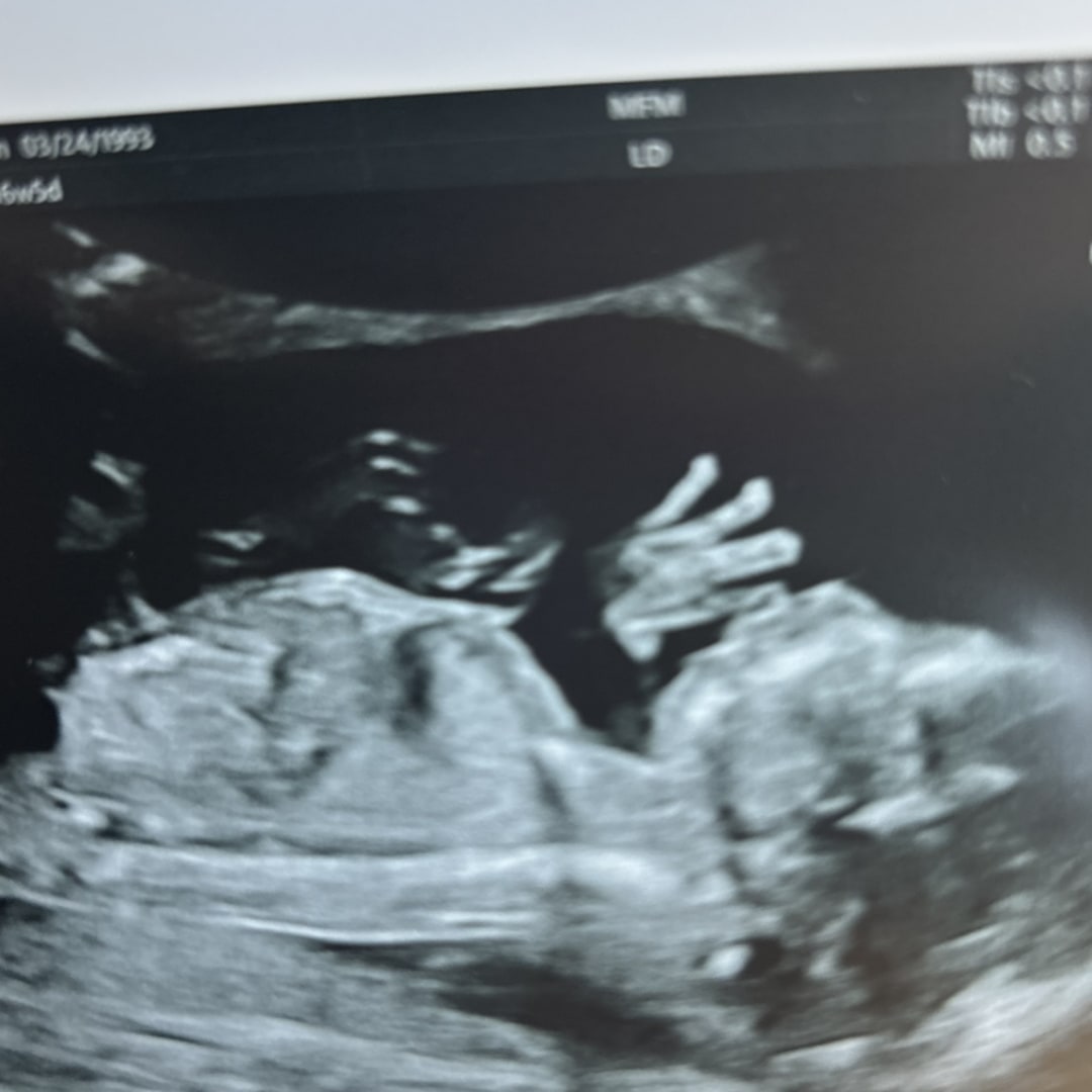 Photo shared by Meghan for their Babylist baby registry.