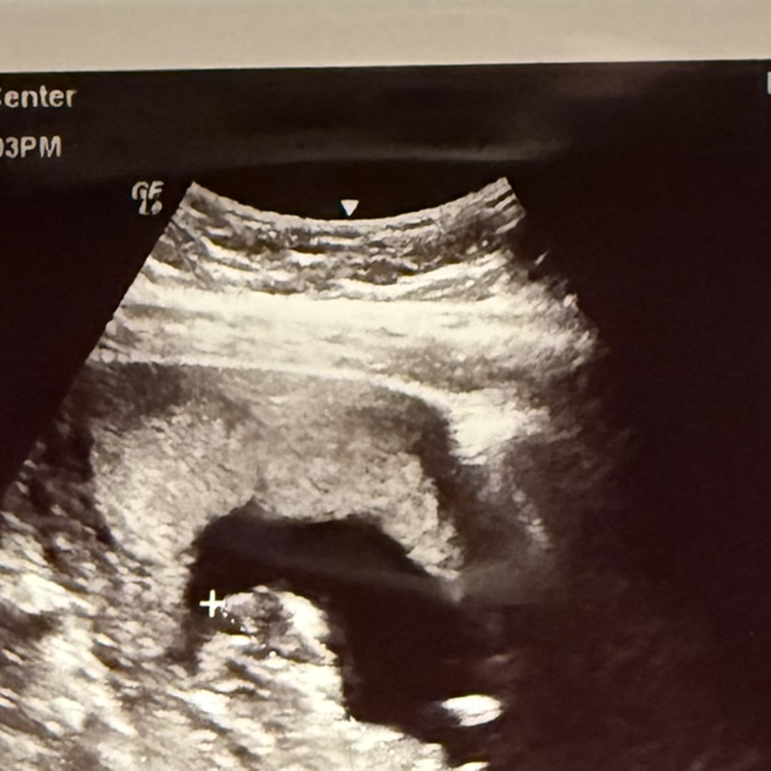 Photo shared by Melissa for their Babylist baby registry.