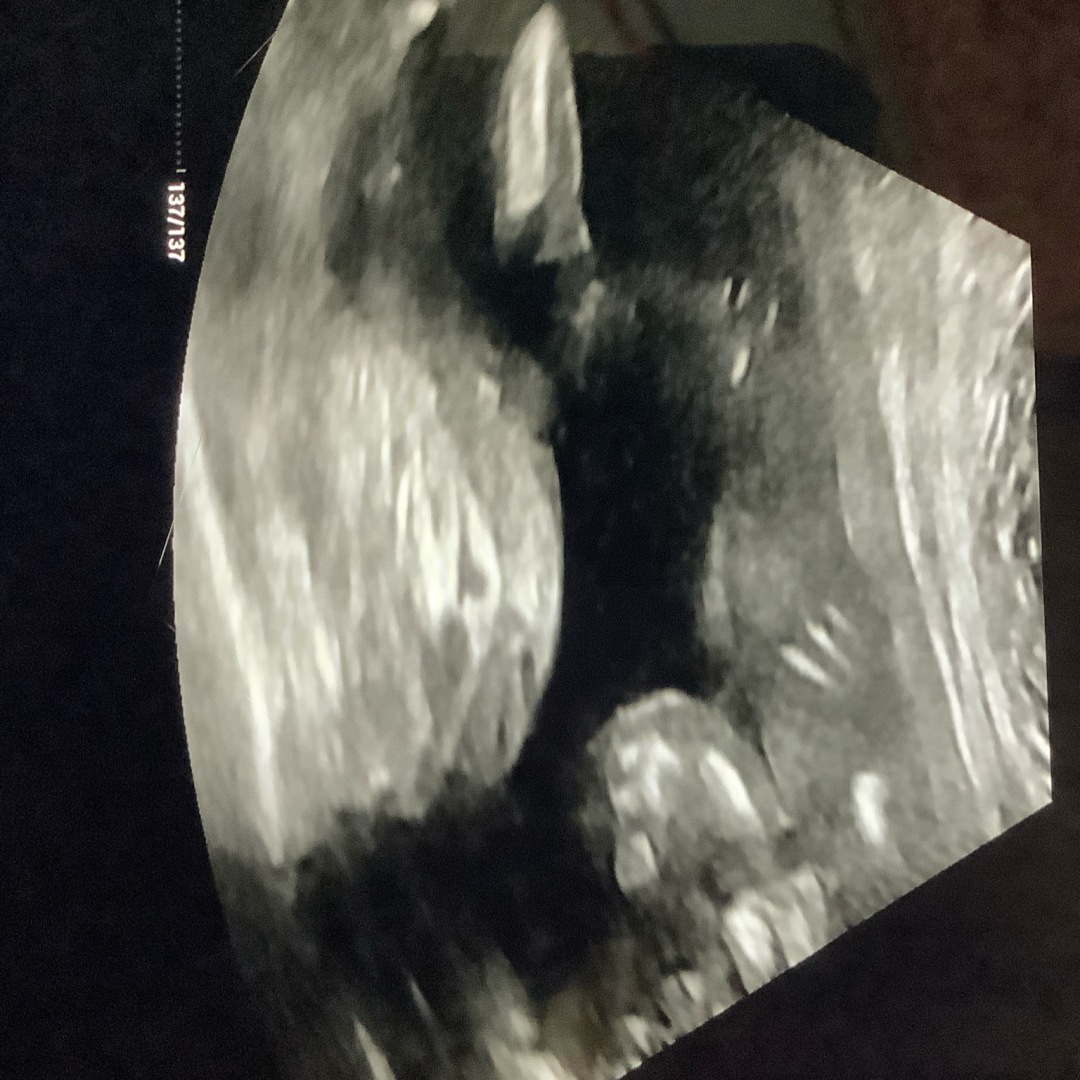 Photo shared by Zachary for their Babylist baby registry.