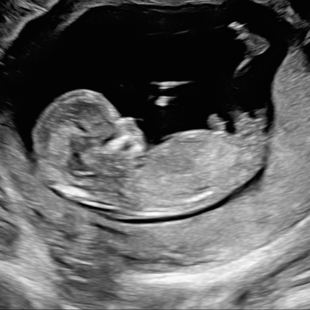 Photo shared by Brittany for their Babylist baby registry.