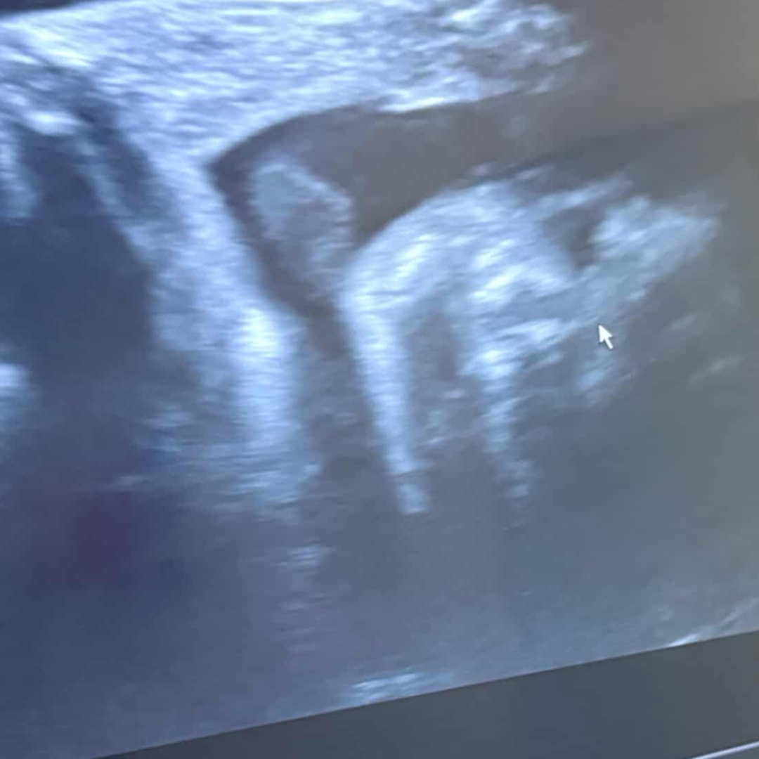 Photo shared by Dream for their Babylist baby registry.