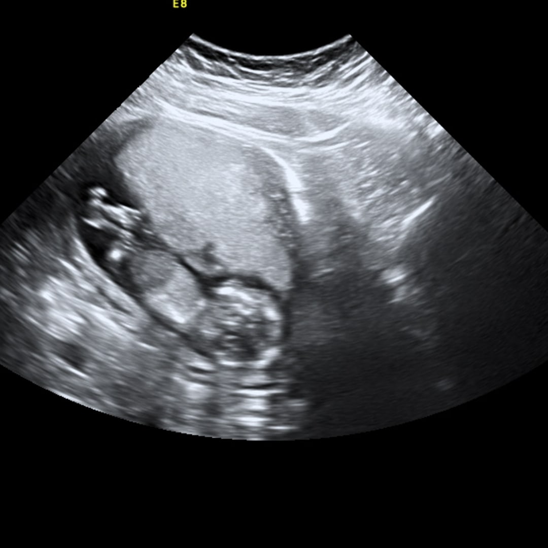 Photo shared by Claudia for their Babylist baby registry.