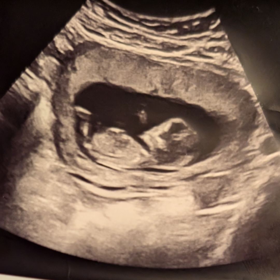 Photo shared by Destiny for their Babylist baby registry.